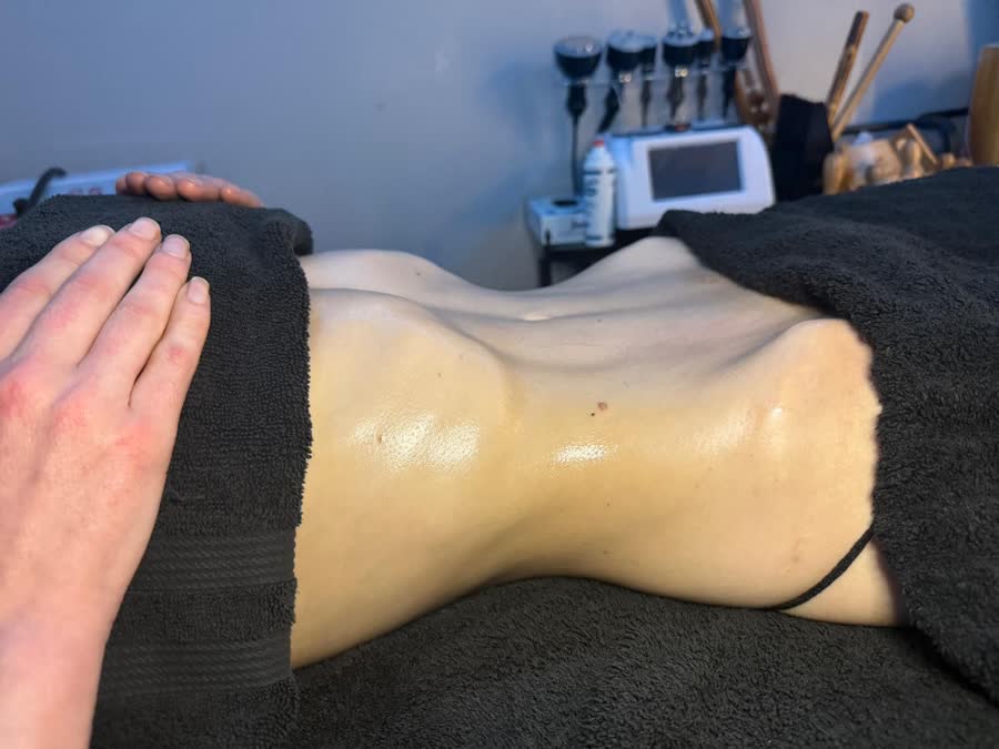 Body contouring